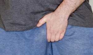 Основные причины появления зуда на конце головки и отсутствия выделений