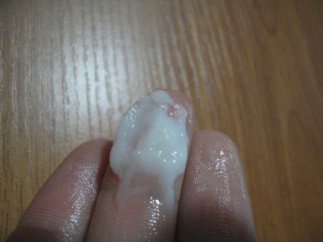 Белые выделения