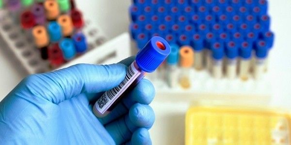 Анализ крови на ХГЧ