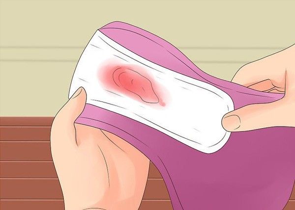 Кровянистые выделения