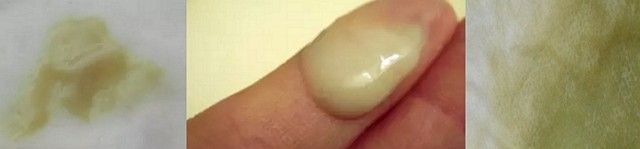 Выделения зеленого цвета