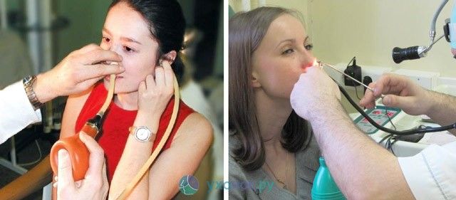 Продувание уха