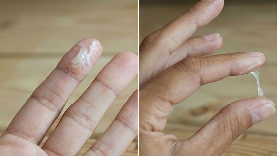 Слизистые выделения